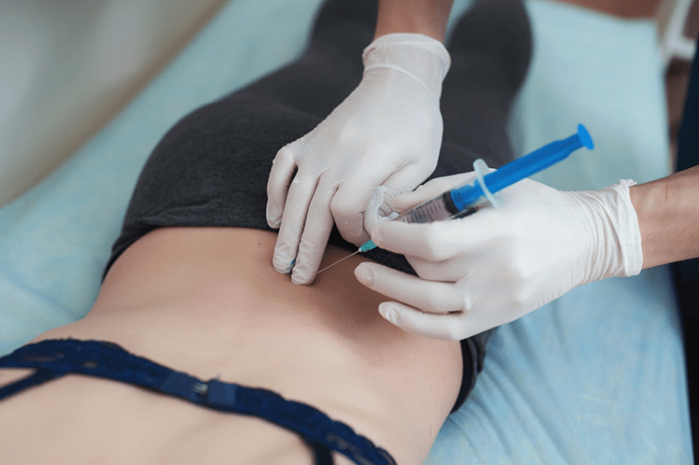 αποκλεισμός στην οσφυϊκή οστεοχόνδρωση